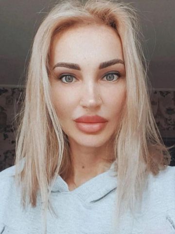 Альбина